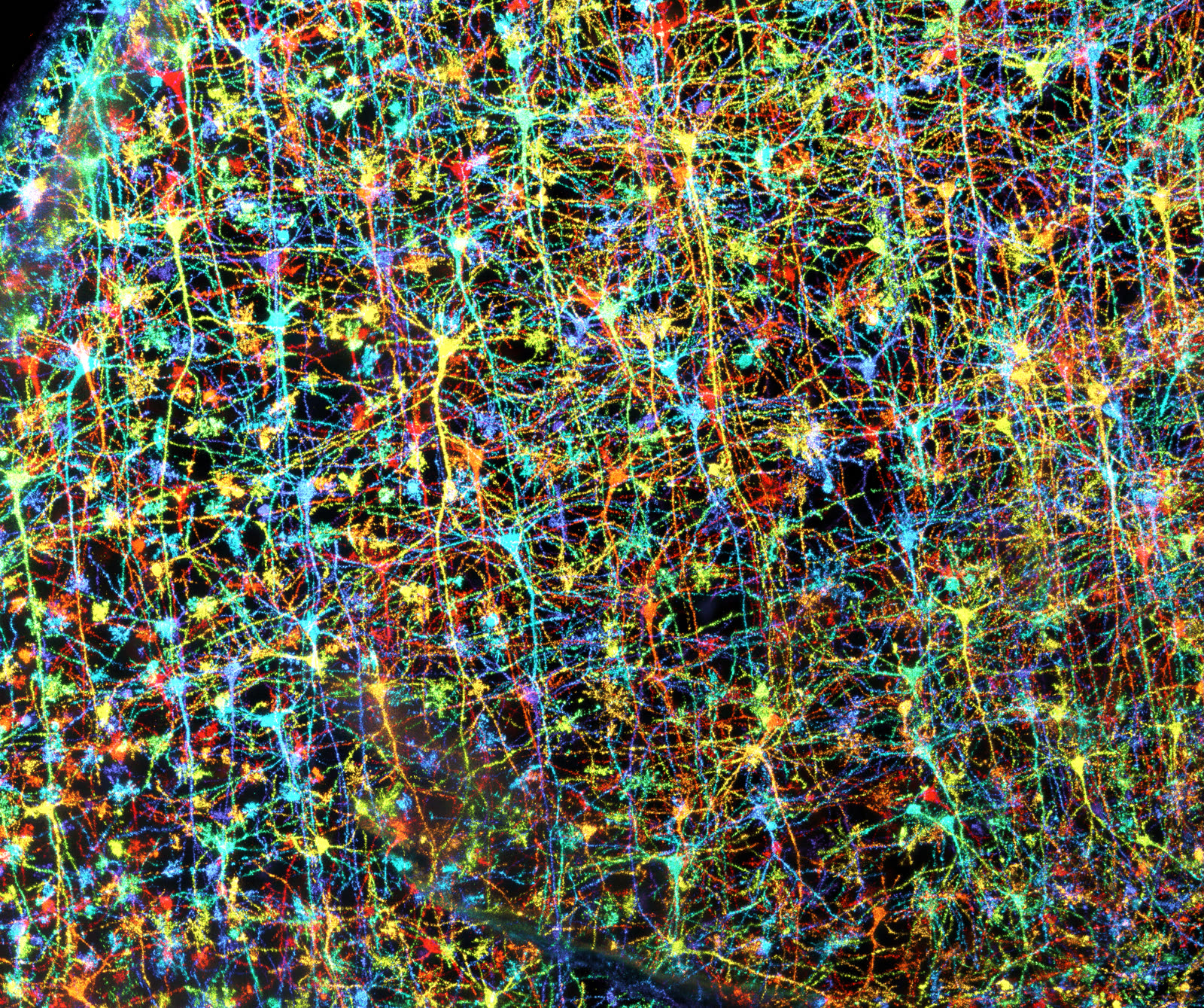 Golgi-X7-ExM: Human frontal cortex neural network